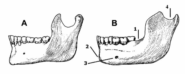 Neanderthal mandible