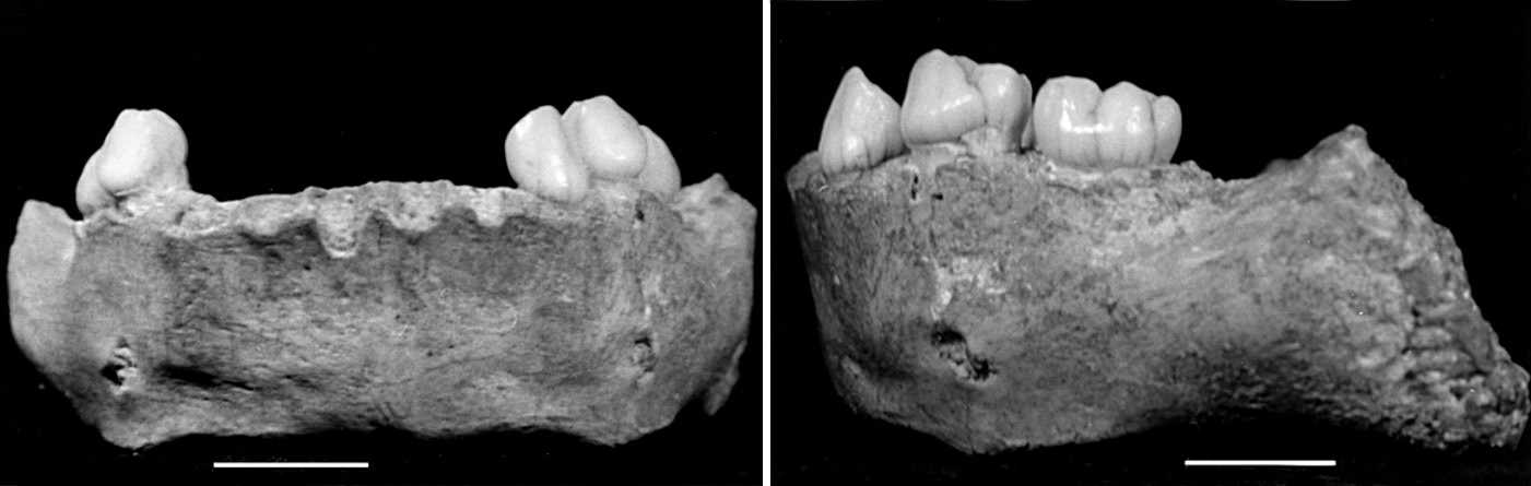 Archi 1 mandible