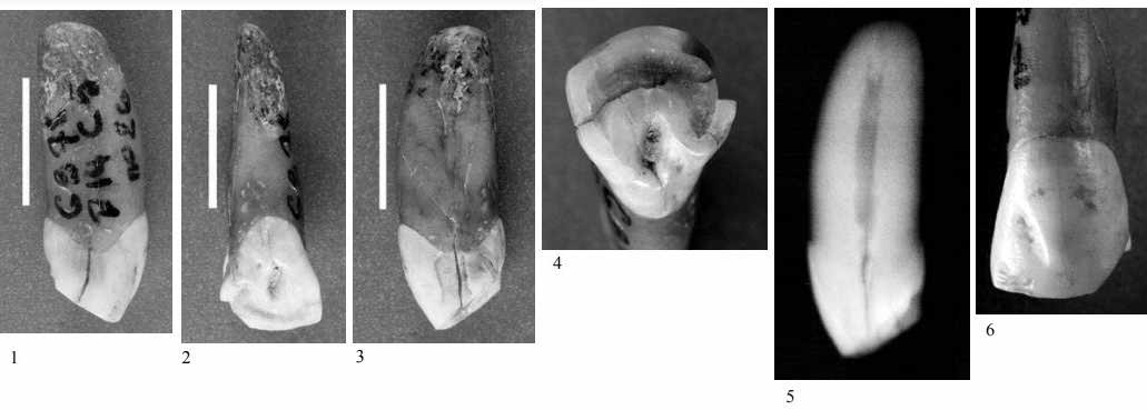 Boccard incisor