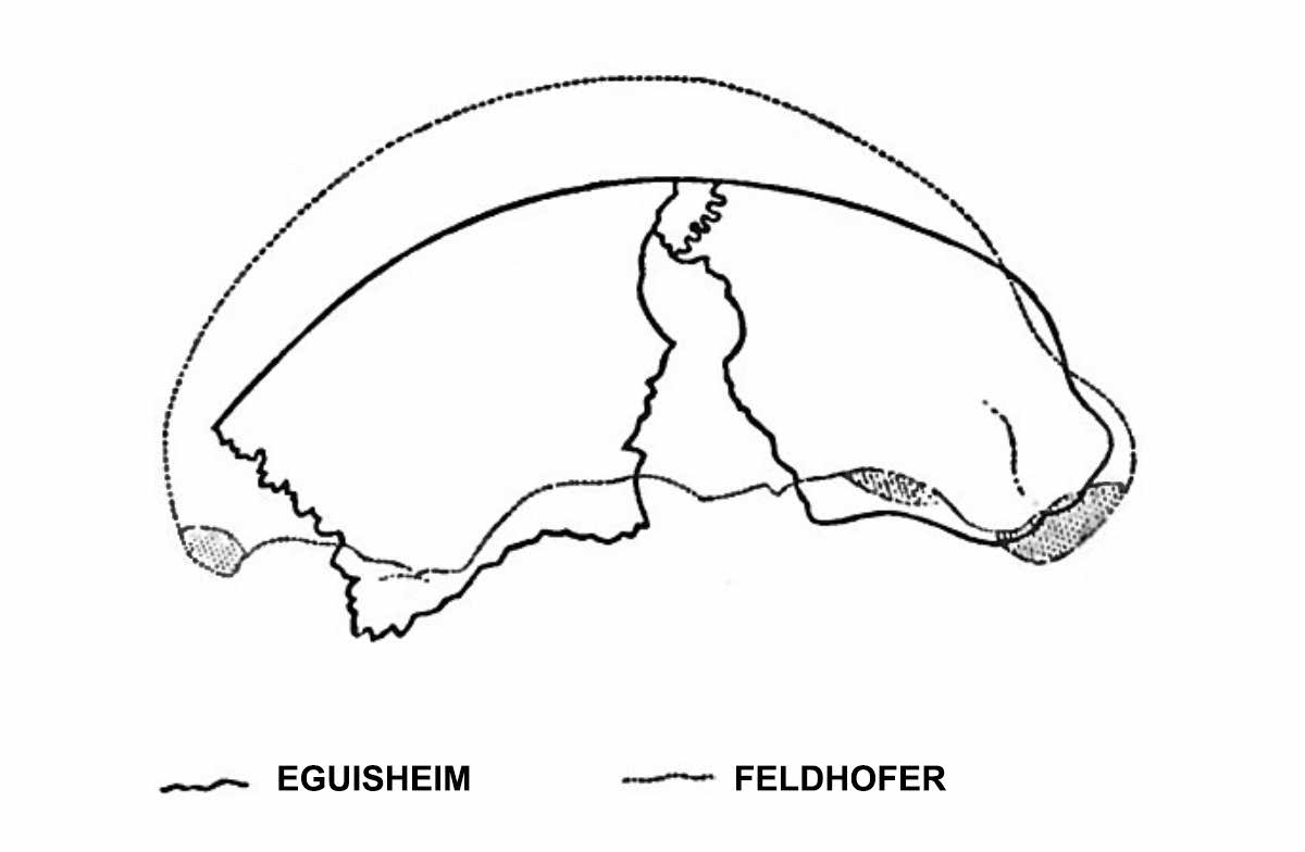 Comparison of the Neanderthal and the Eguisheim skulls.