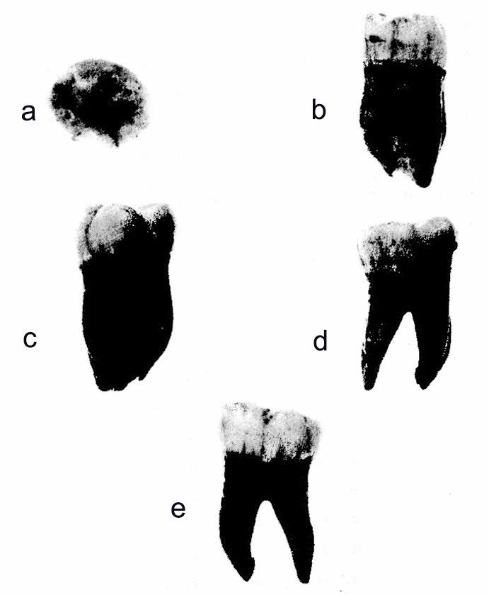 Fossellone 3 first molar