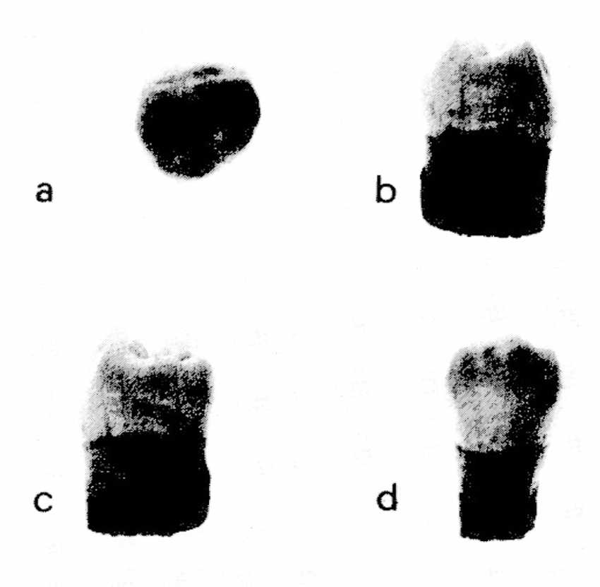 Fossellone 3 premolar