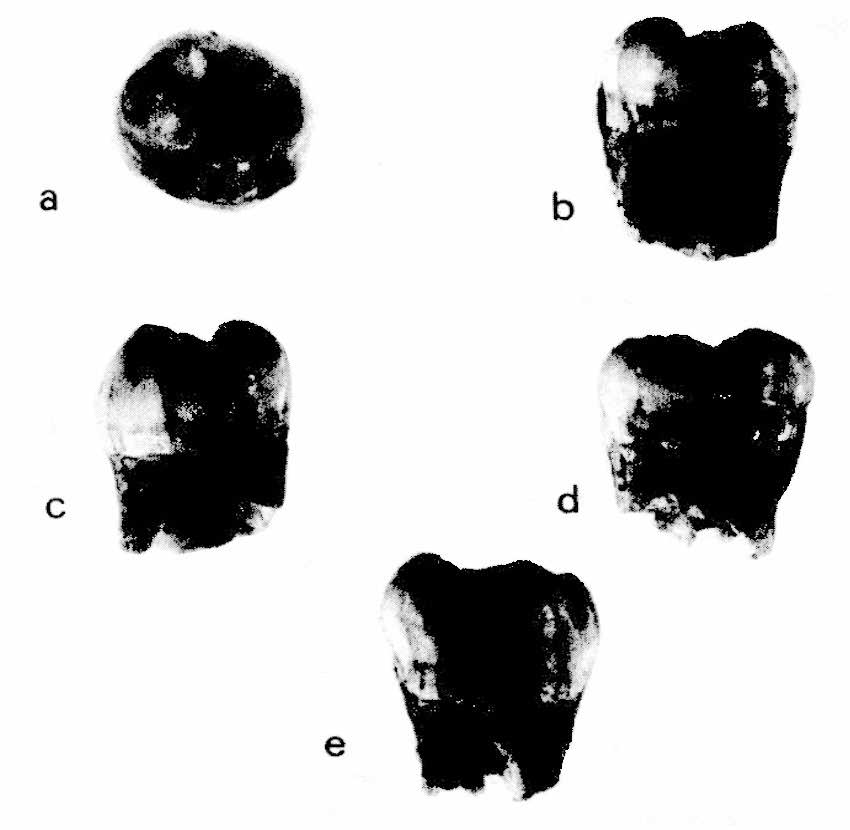 Fossellone 3 second molar