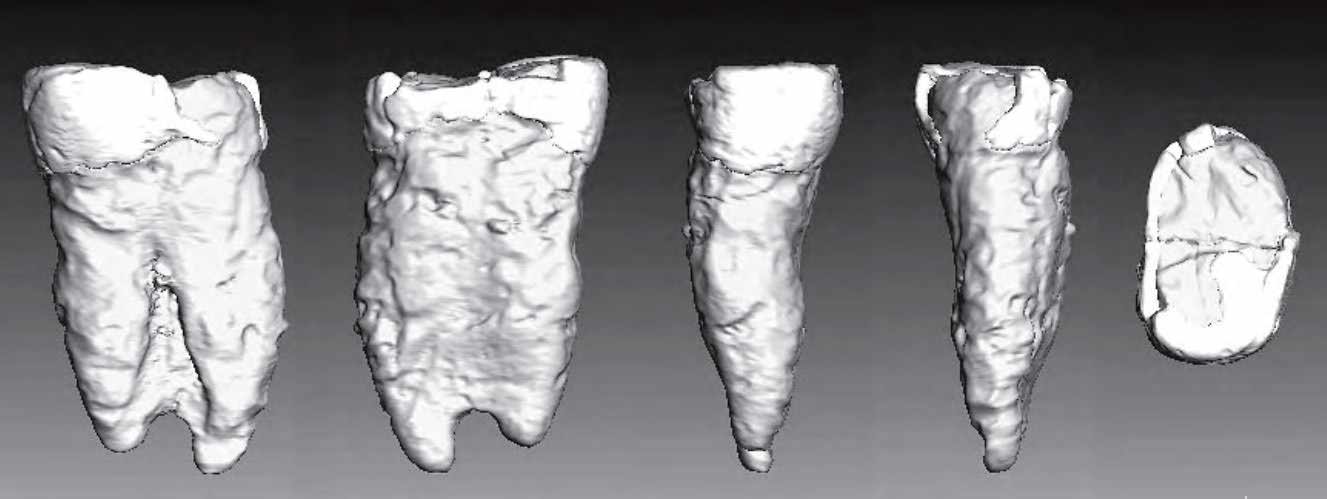 Neanderthal tooth from Jonzac