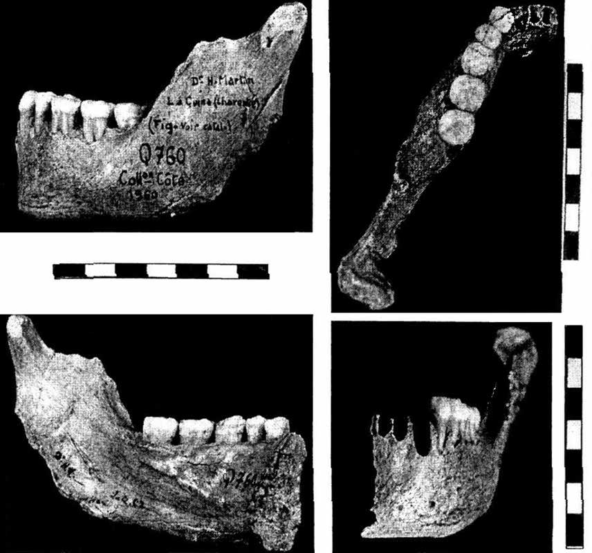 La Quina H9 hemimandible