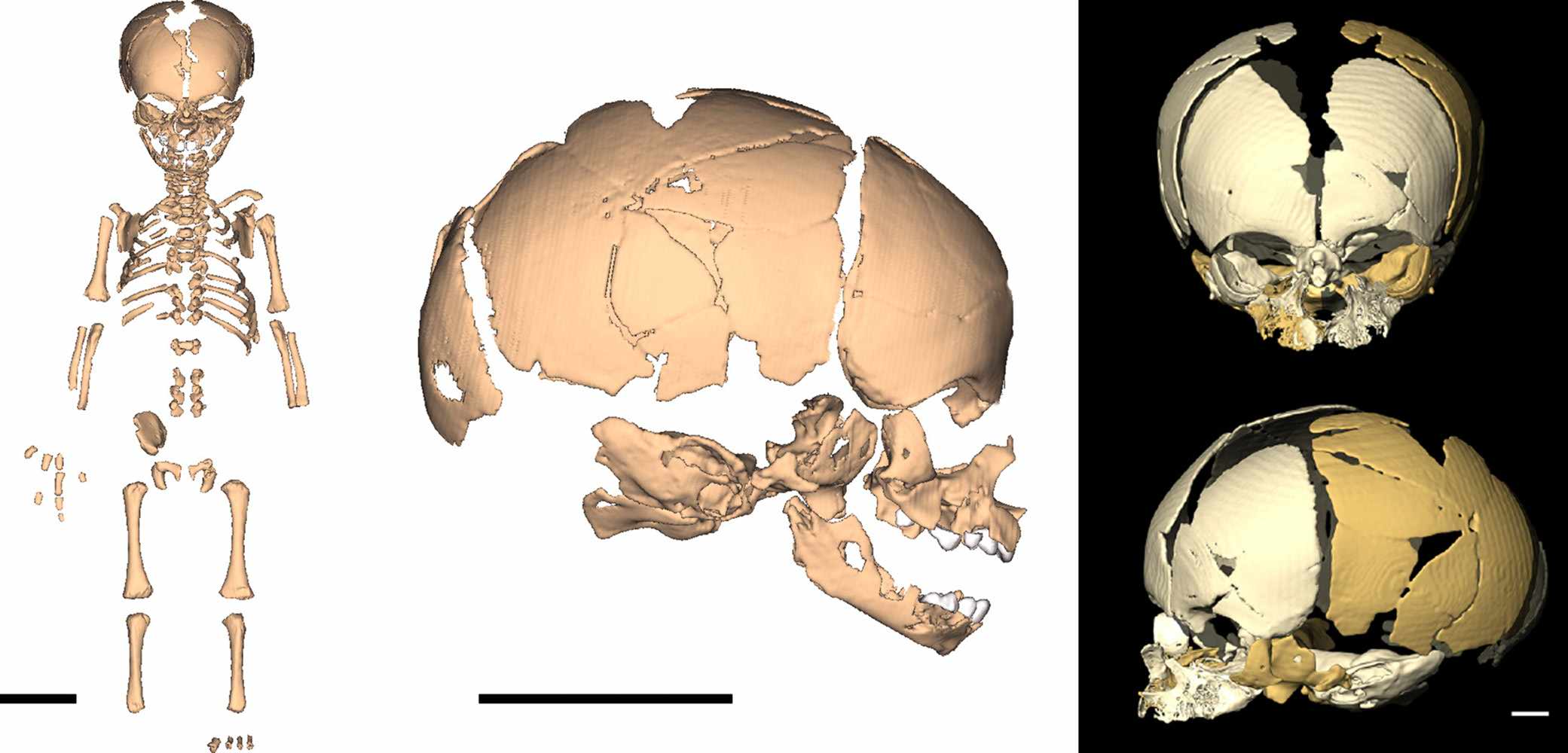 Mezmaiskaya Neanderthal infant