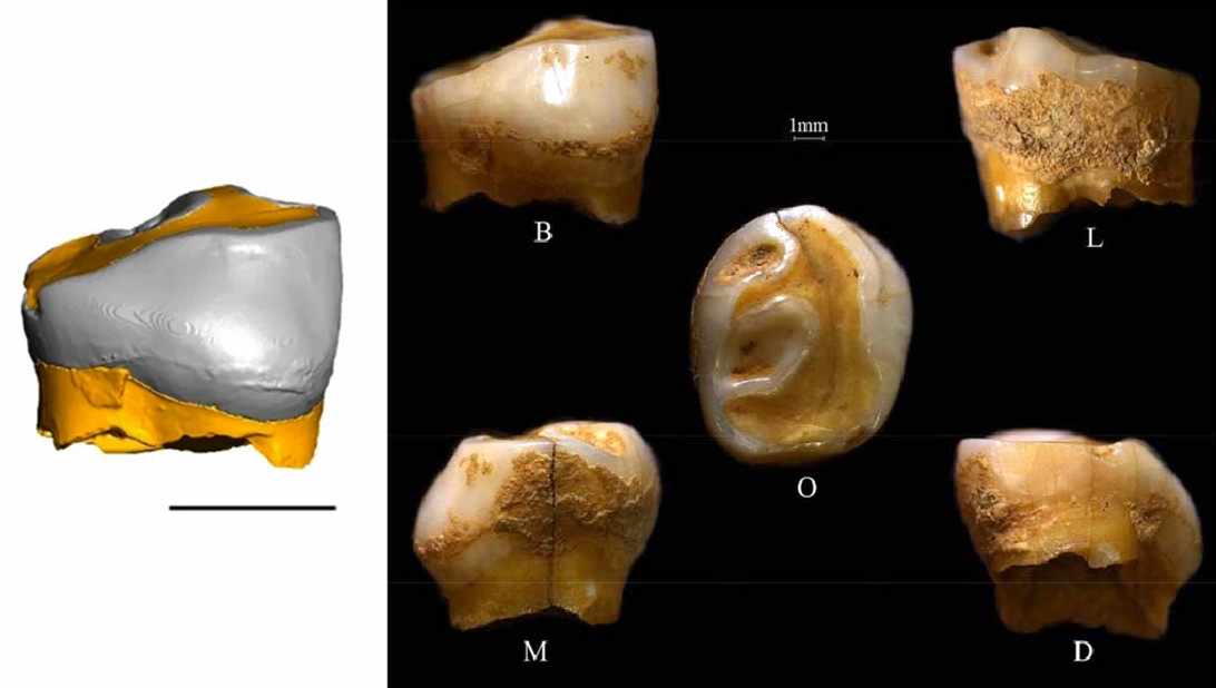 Nadale 1 tooth