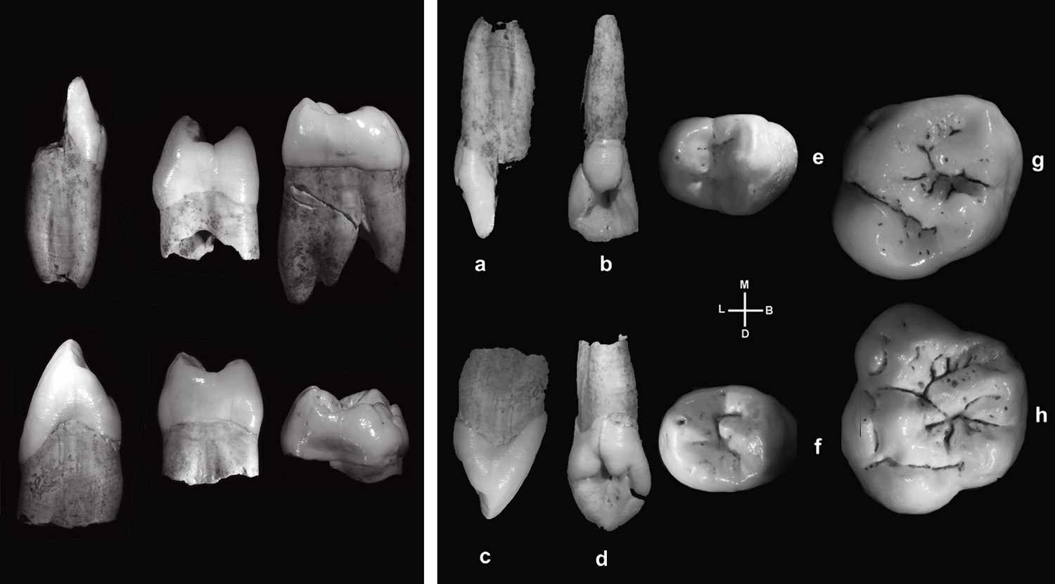 Obi-Rakhmat teeth