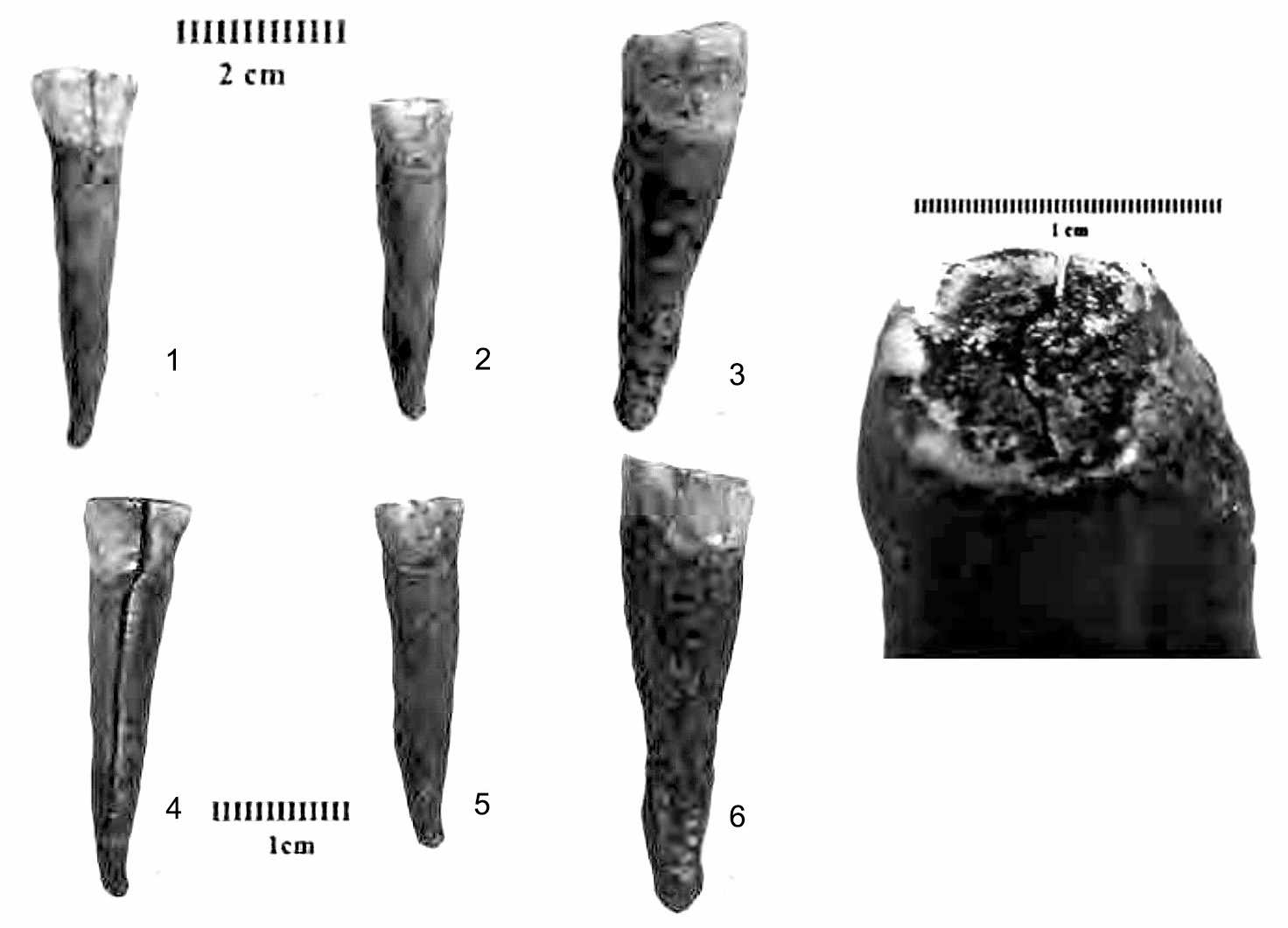 Remete-Felso teeth