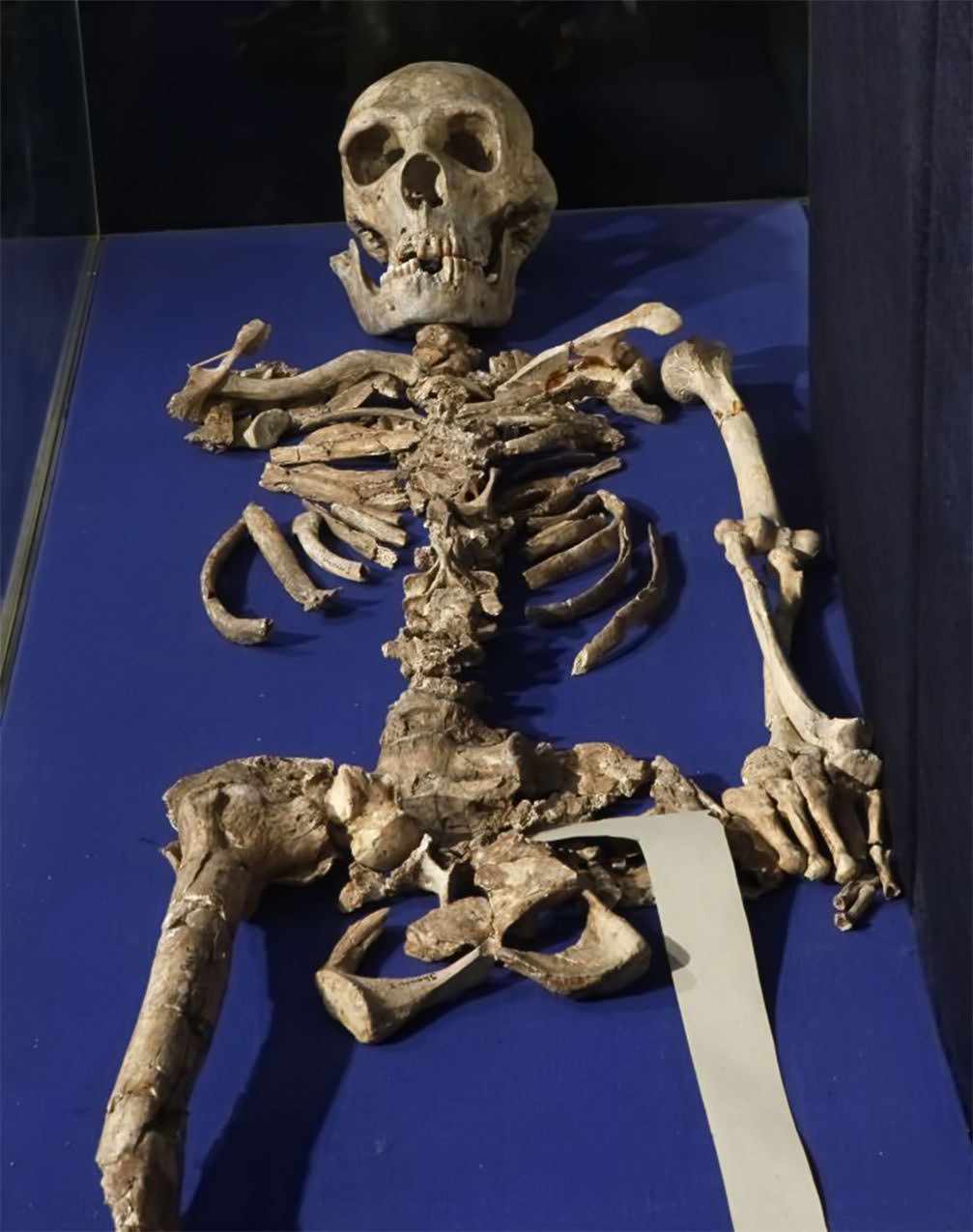 Shanidar 1 skeleton