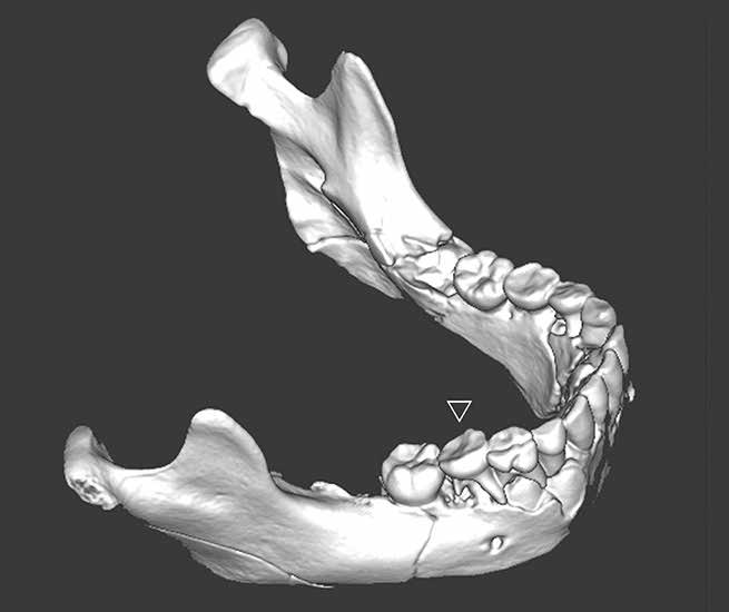 Teshik-Tash mandible