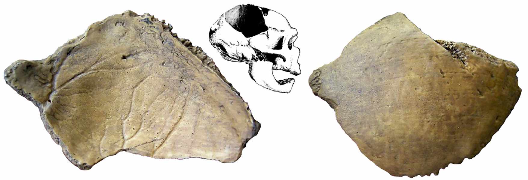 Warendorf skull fragment