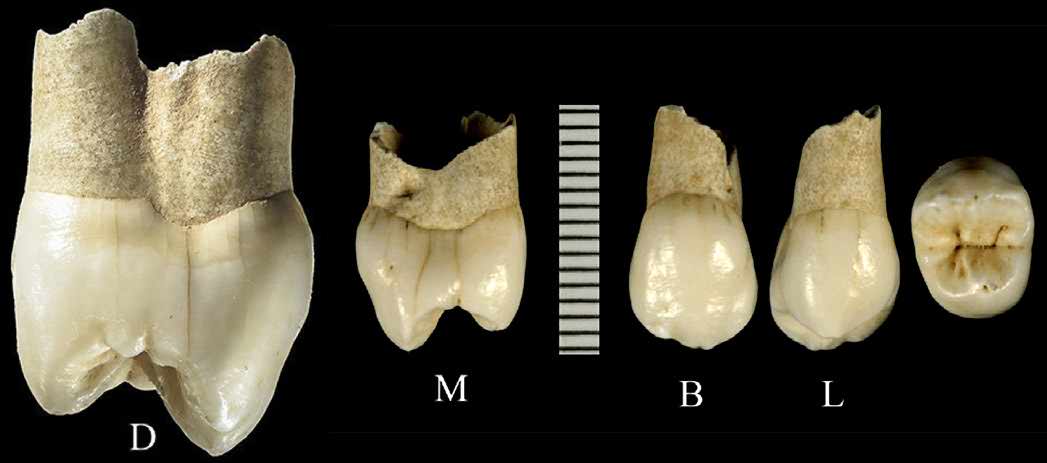 Wezmeh premolar tooth 