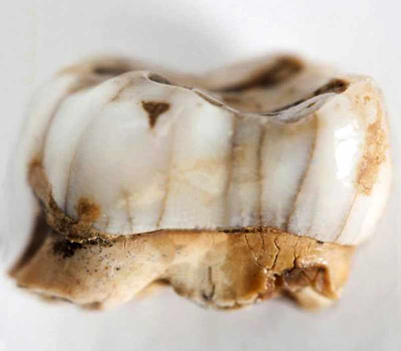 Arrilor. Neanderthal tooth