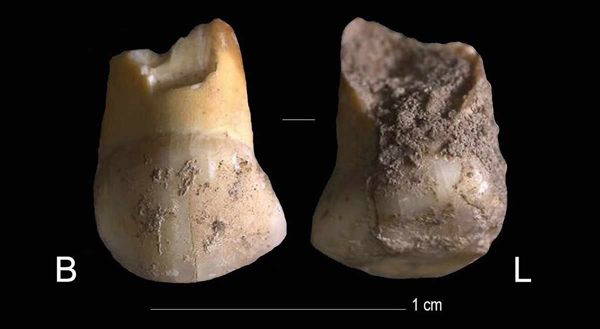 Riparo Broion deciduous tooth