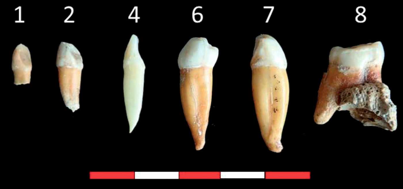 Castaigne isolated teeth