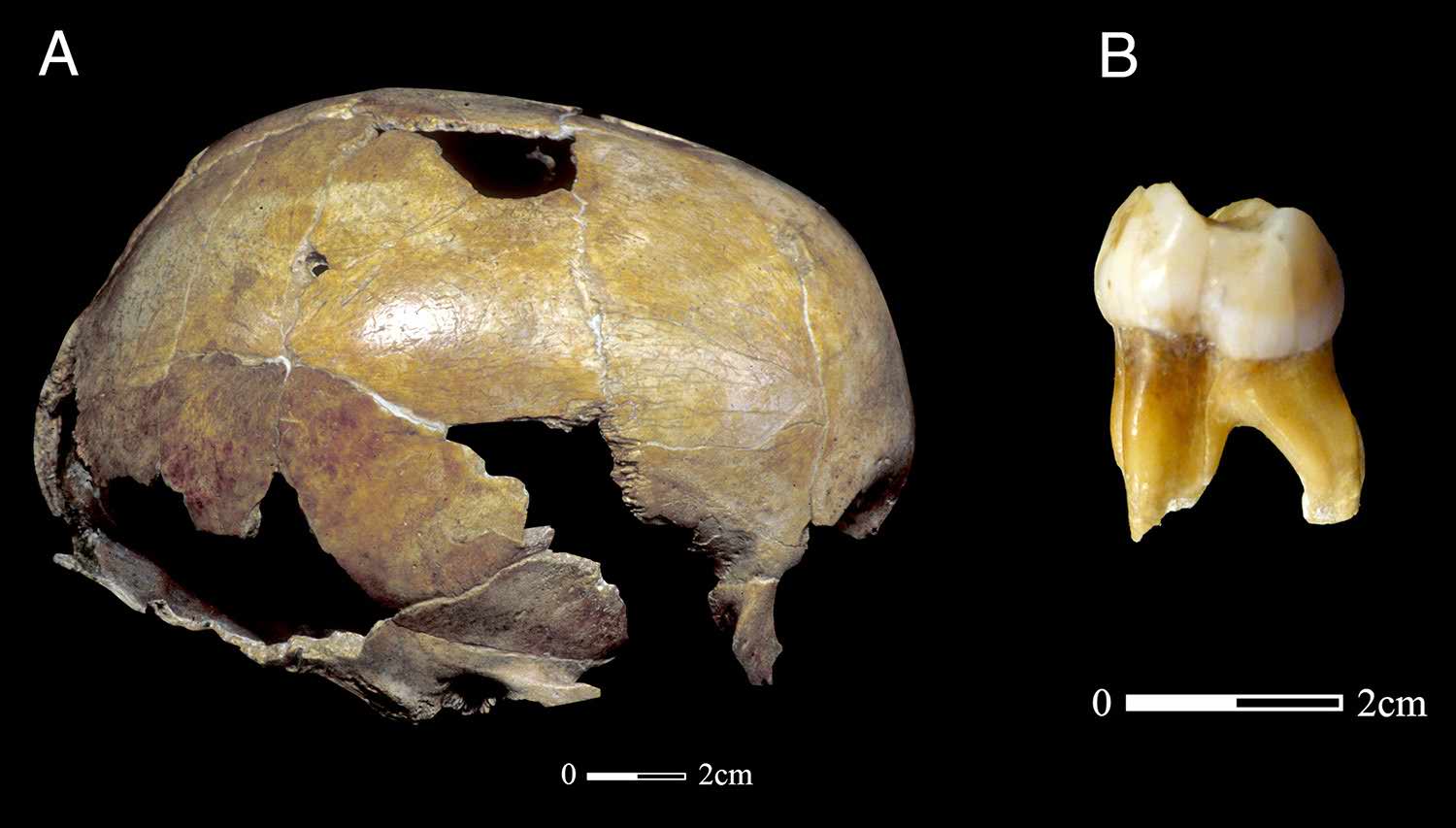 Neanderthal Child Engis 2