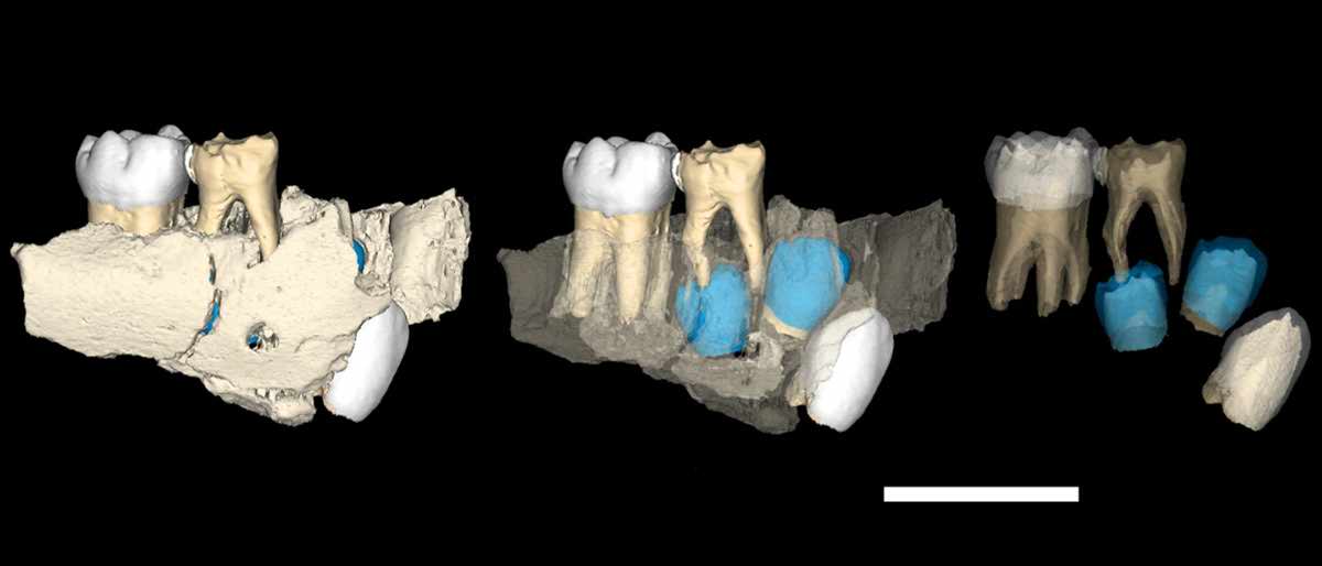 Gegant G5 teeth