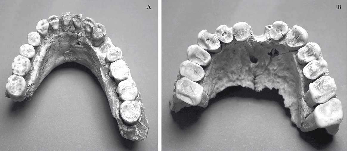 The jaws from Grotte du Renne