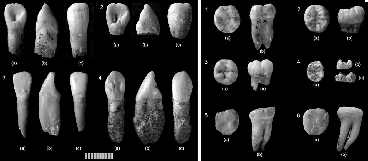 Dental remains from Grotte du Renne