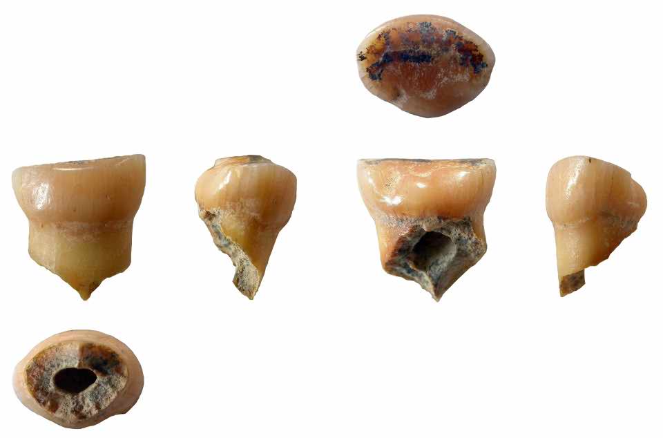 Neanderthal incisor from Noisetier