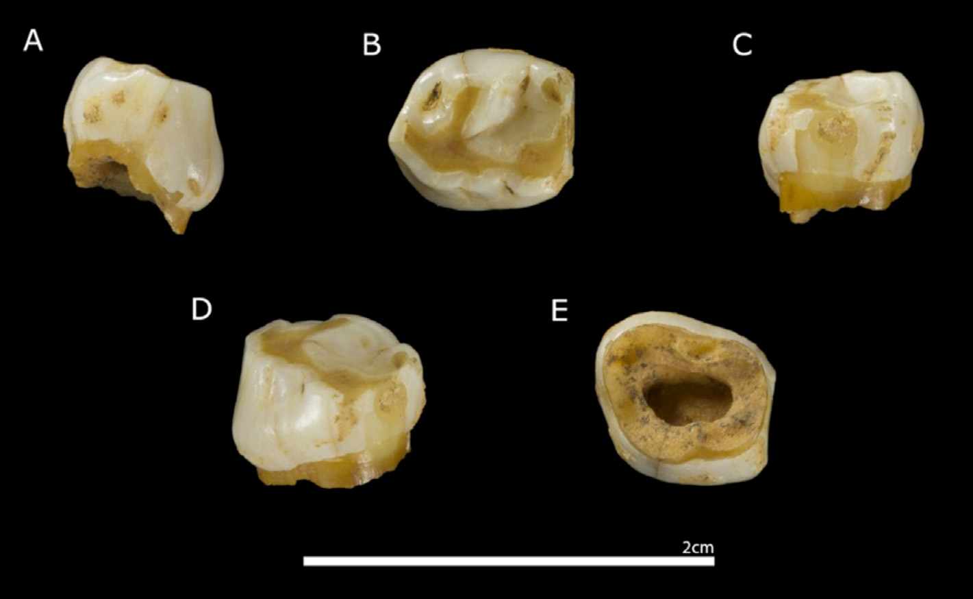 Deciduous molar from Prado Vargas Cave