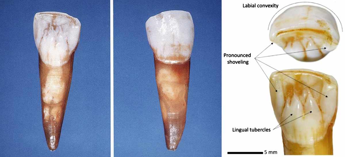 Neanderthal incisor from Saint-Brais