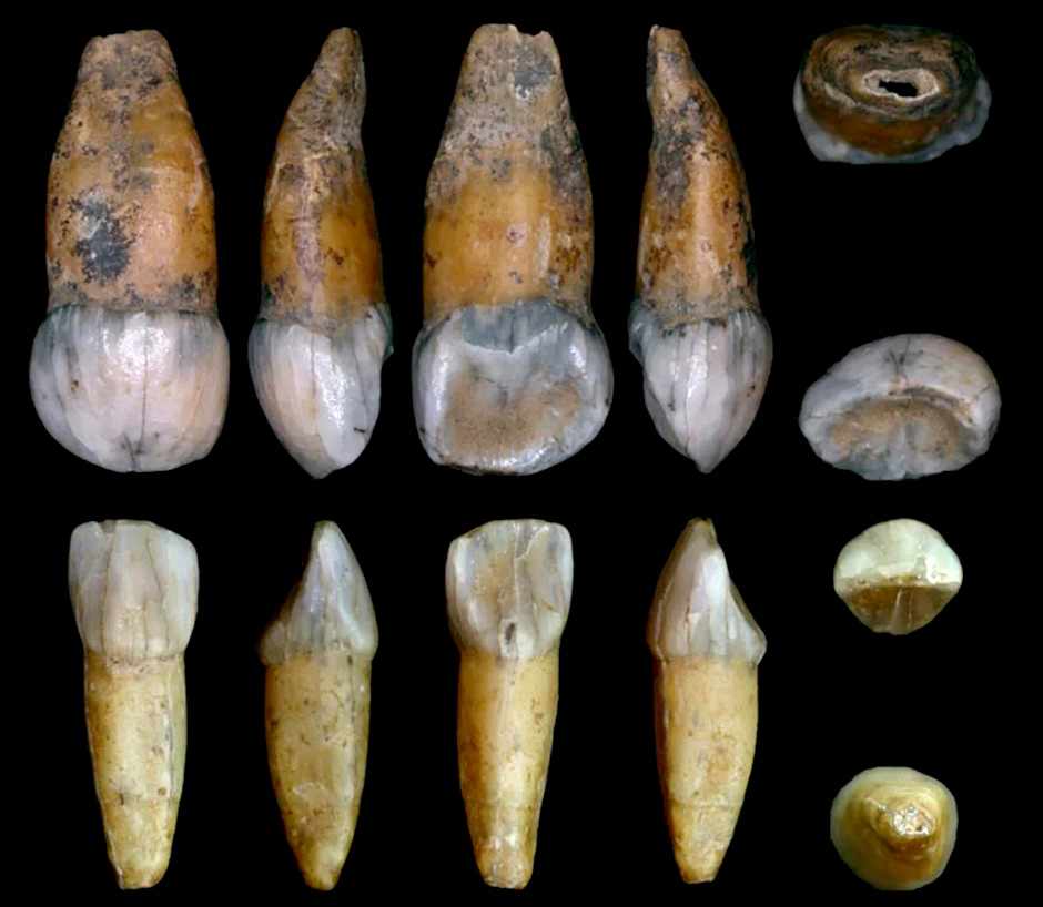 Jaw and teeth of a Neanderthal Spy-4