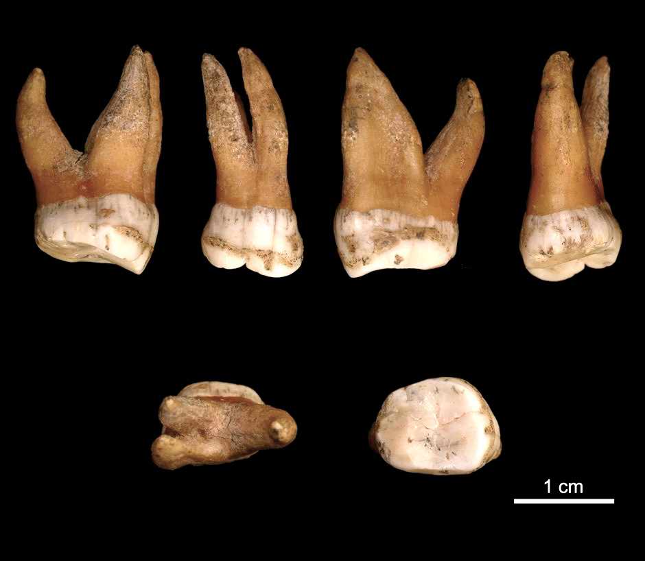 Molar of a Neanderthal, Spy 94a