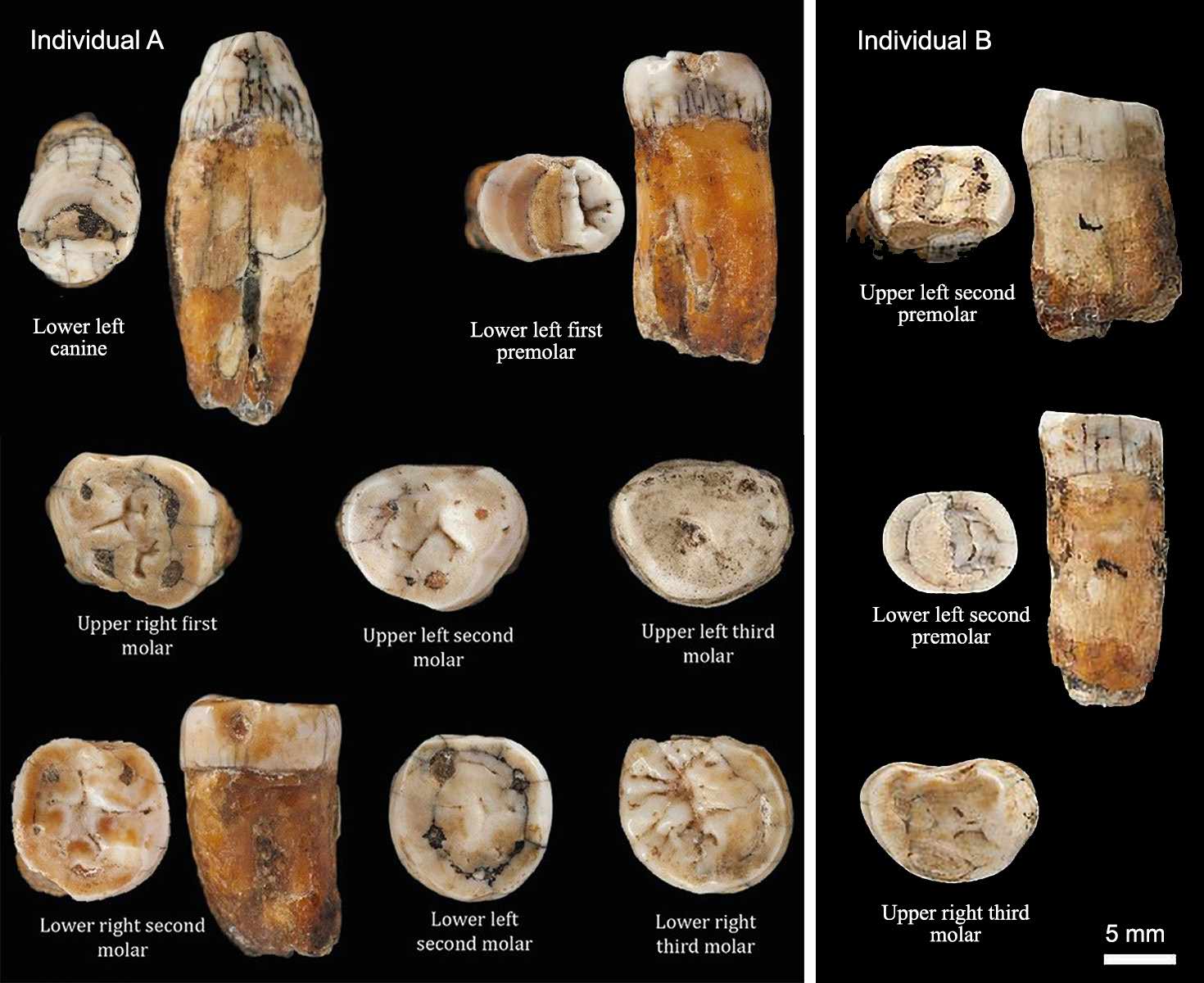 Neanderthal fossils: St. Brelade tooth