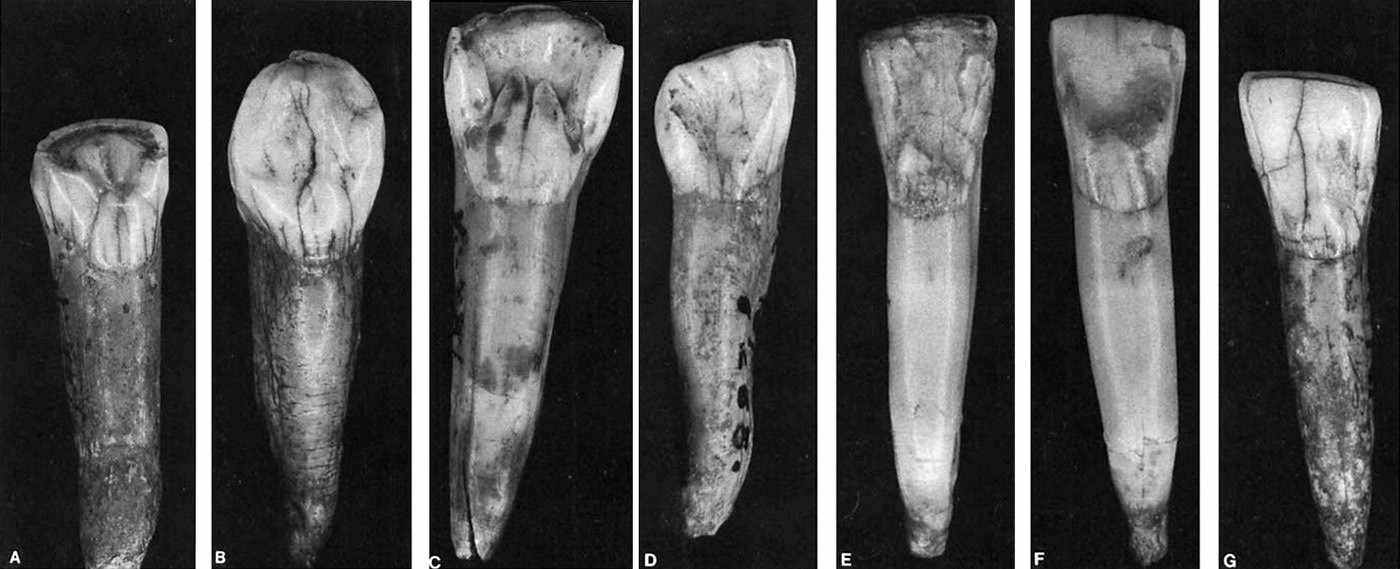 Vindija anterior teeth